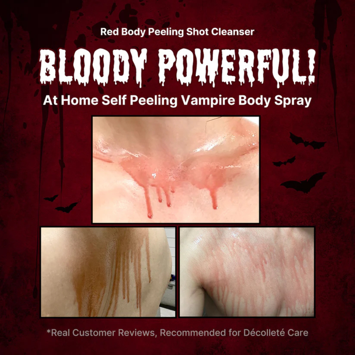 Medicube - Red Acne Body Peeling Shot 110g