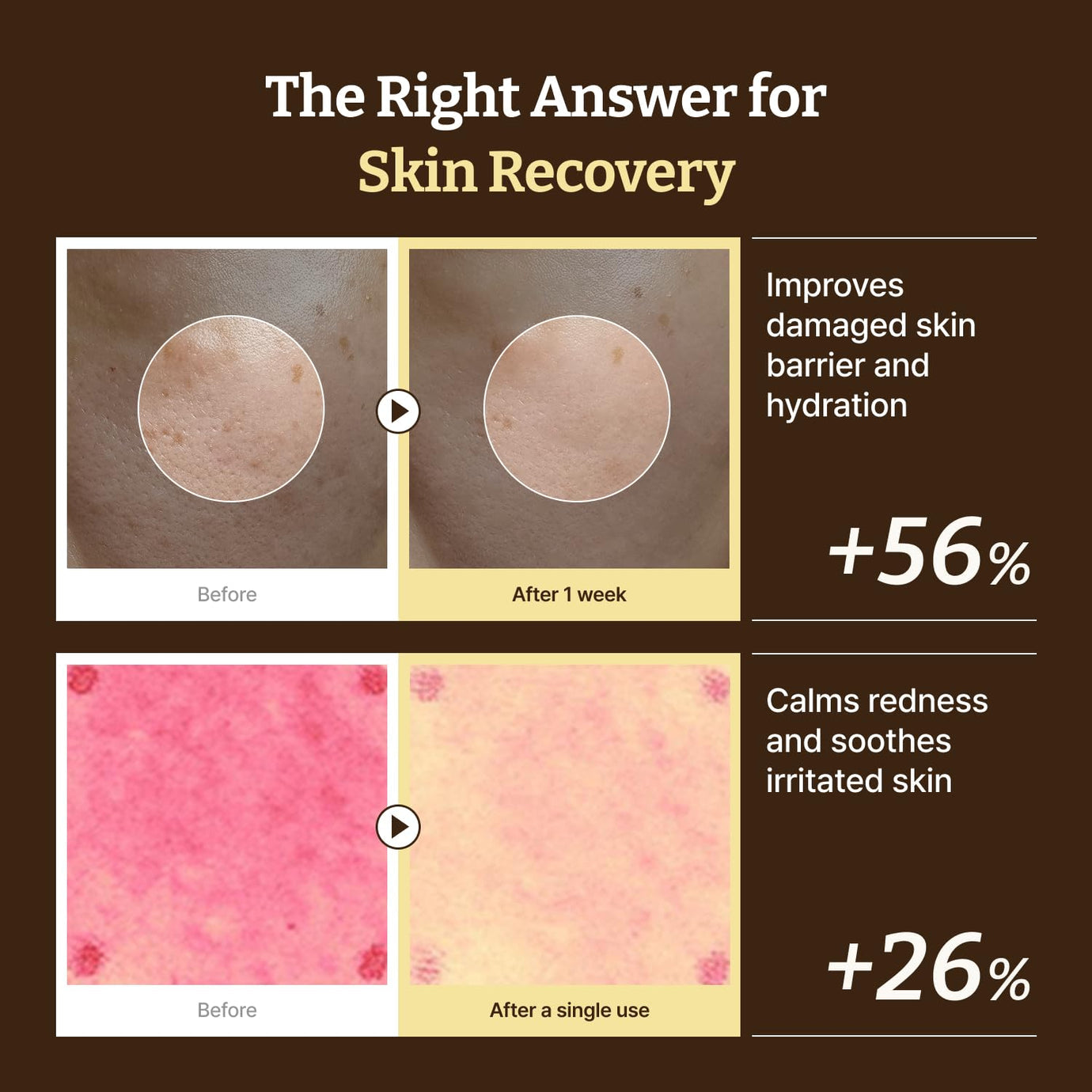 Dr.Reju-All - Advanced PDRN Rejuvenating Cream