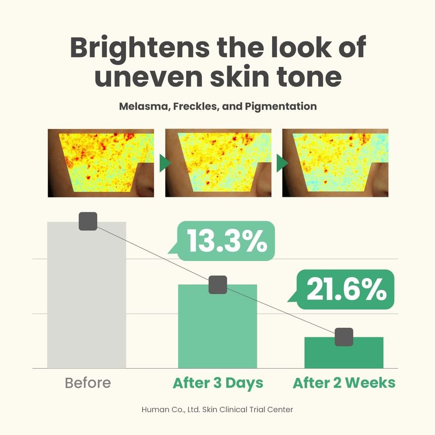 Axis-y - Dark Spot Correcting Glow Serum