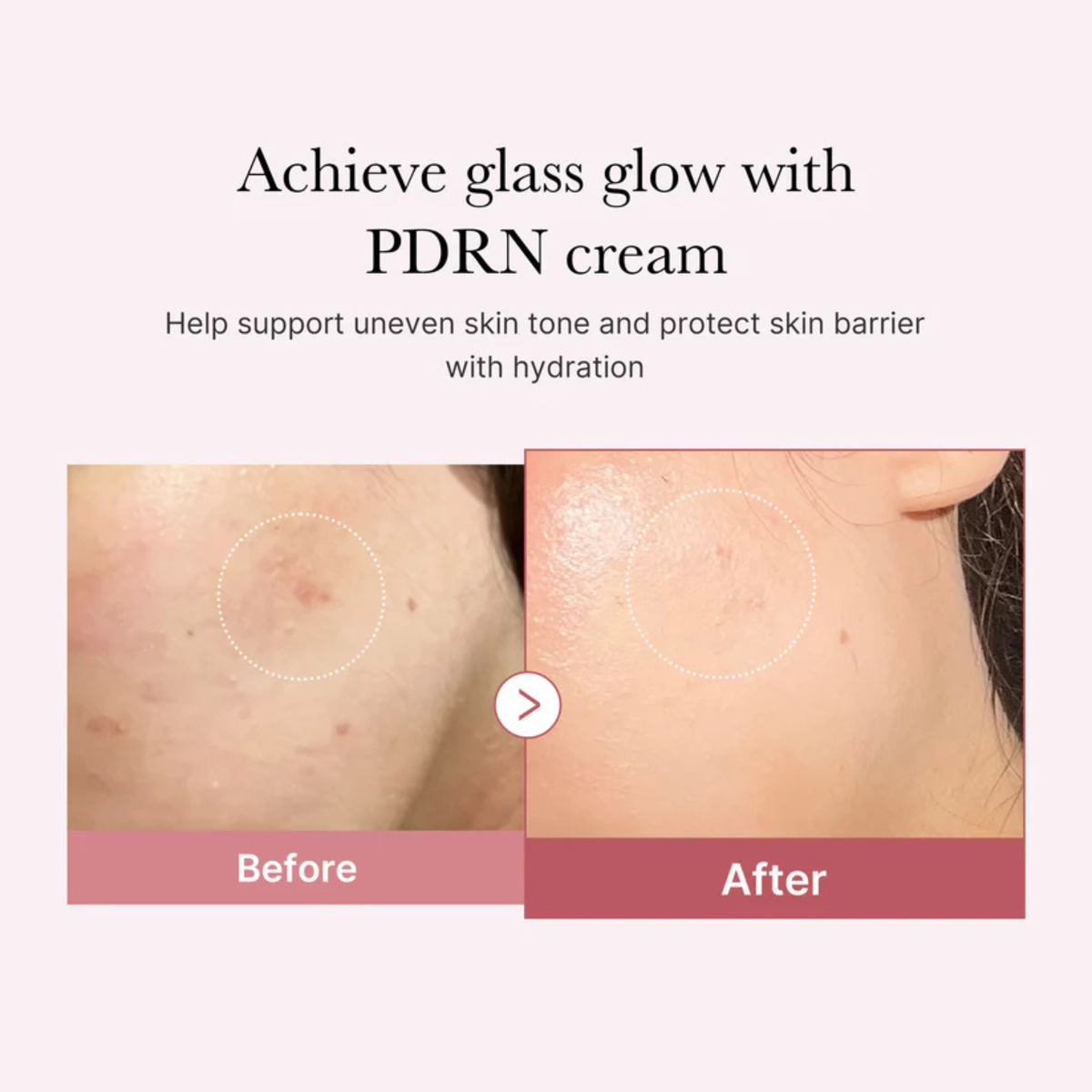 Medicube - PDRN Pink Hyaluronic Moisturizing Cream 50ml