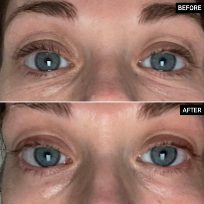 Retinol Eye Cream - The Inkey List