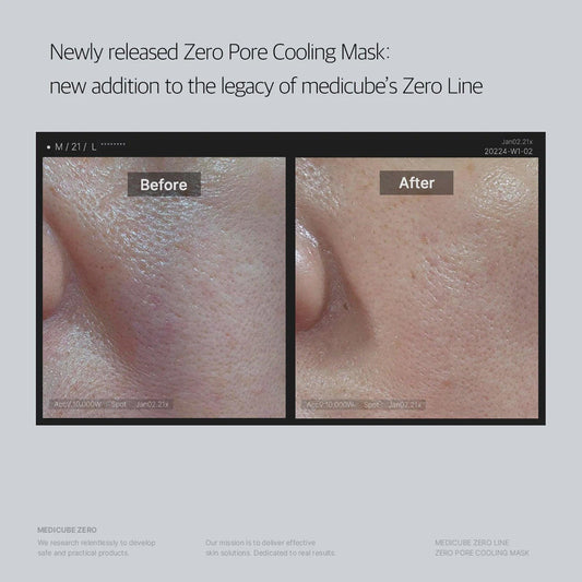 Medicube - Zero Pore Cooling Mask 1pc